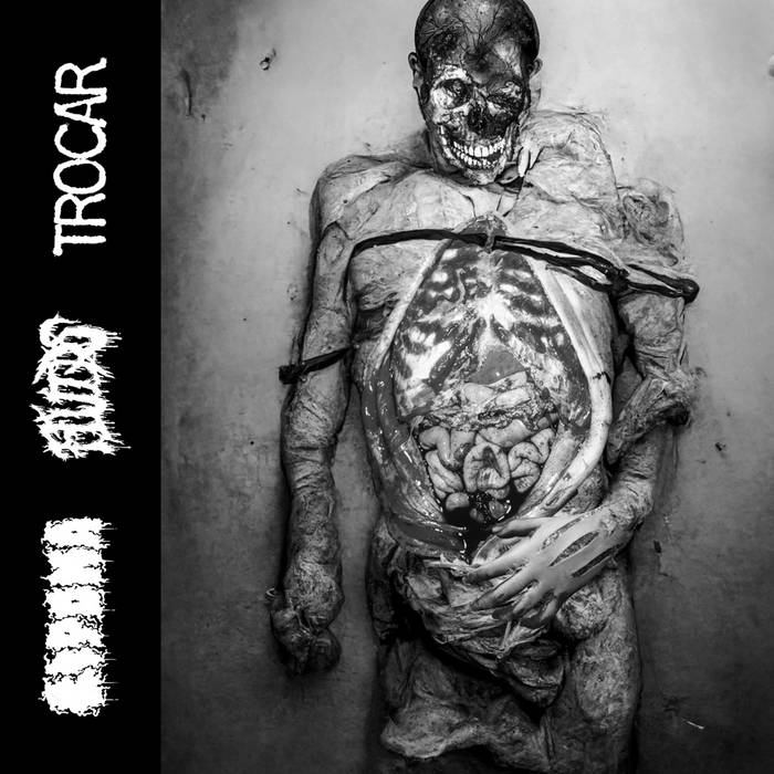 Fluids/Lipoma/Trocar 