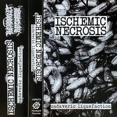 Ischemic Necrosis 